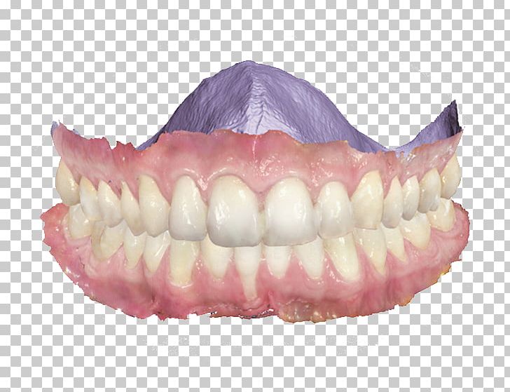 Scanner Dentistry 3Shape Patient PNG, Clipart, 3d Scanner, 3shape, Cadcam Dentistry, Cone Beam Computed Tomography, Cosmetic Dentistry Free PNG Download