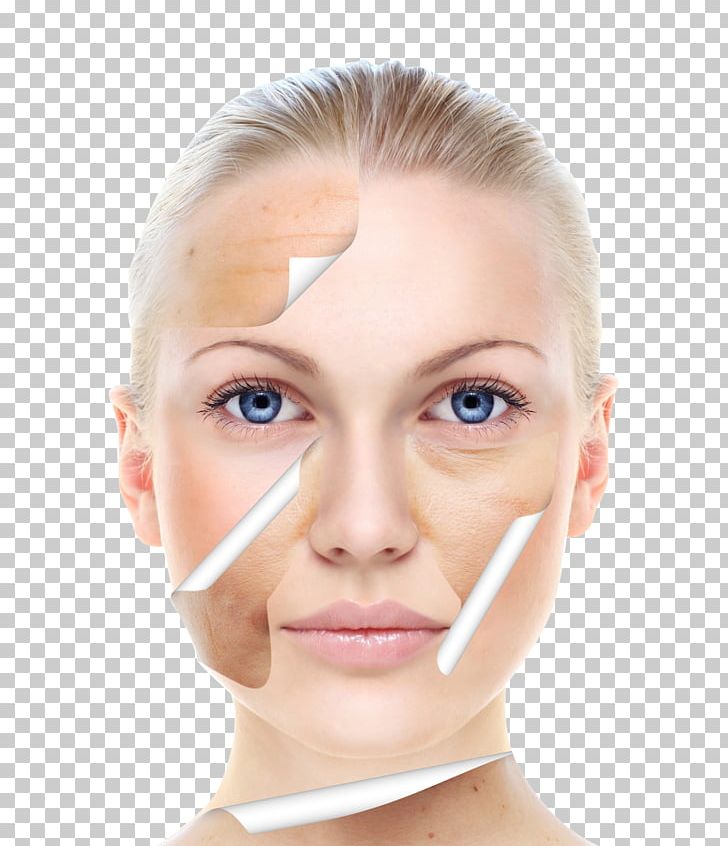 Skin Care Beauty Chemical Peel Facial PNG, Clipart, Acne, Africa Map, Asia Map, Australia Map, Burn Free PNG Download