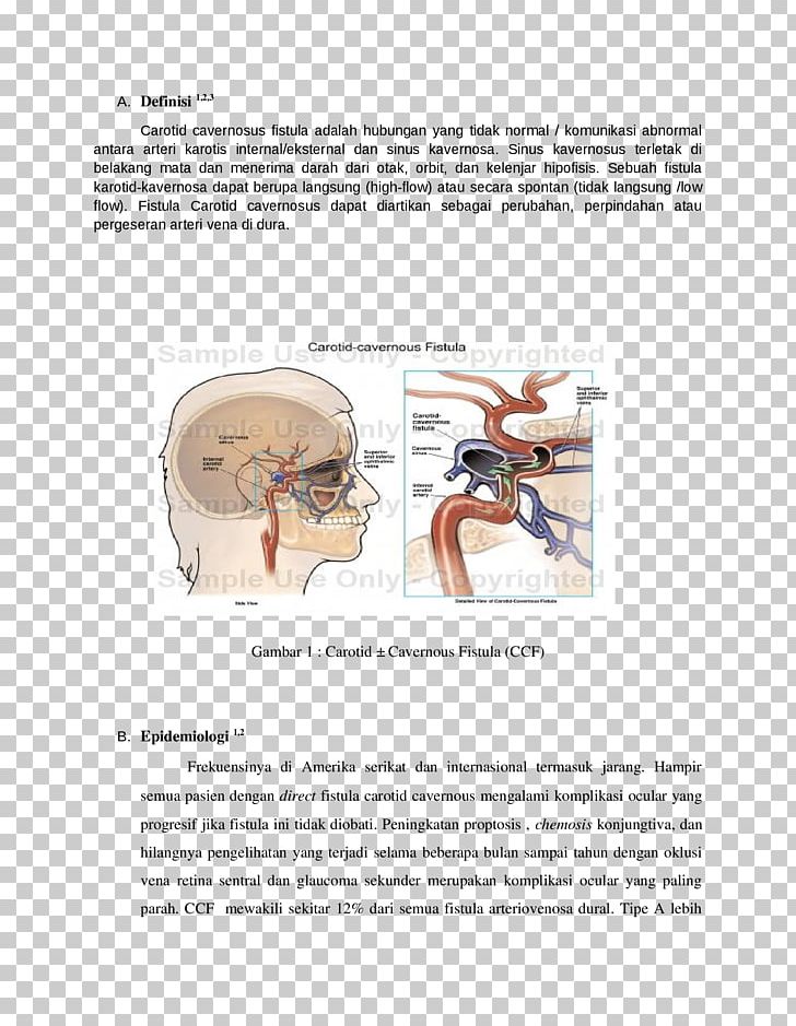 Cavernous Sinus Fistula PNG, Clipart, Art, Cavernous Sinus, Diagram, Document, Docx Free PNG Download