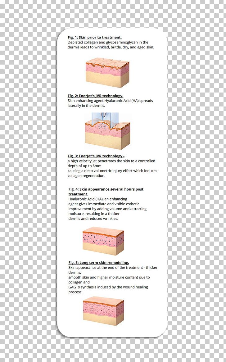 Dermis Scar Hyaluronic Acid Skin Wound Healing PNG, Clipart, Acne, Collagen, Dermis, Face, Healing Free PNG Download