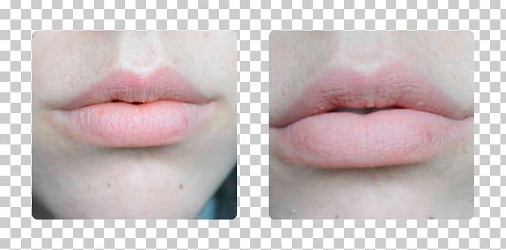 Lip Gloss Close-up PNG, Clipart, Cheek, Chin, Closeup, Eyelash, Jaw Free PNG Download