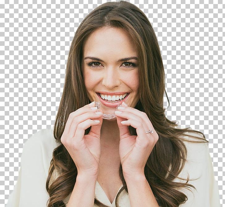 Clear Aligners Dentistry Smile Tooth PNG, Clipart, Academy Of General Dentistry, Beauty, Brown Hair, Cheek, Chin Free PNG Download