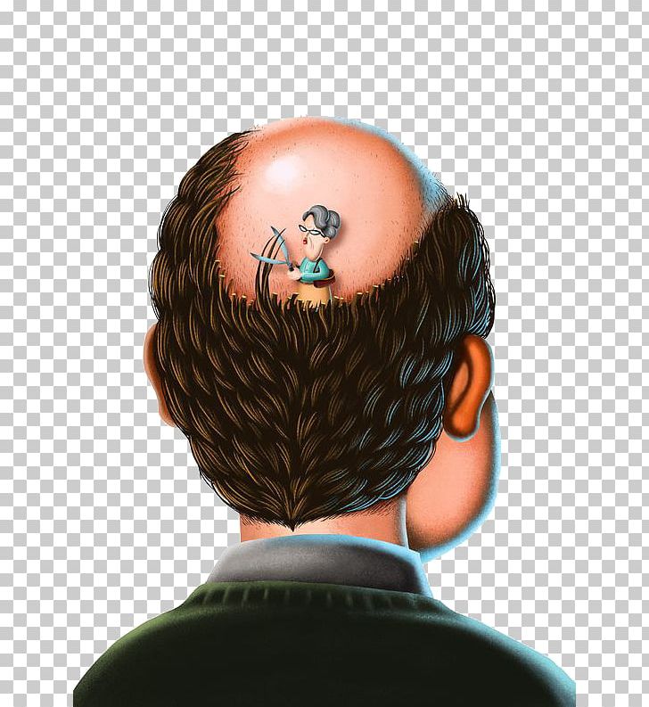 Hair Loss Botak PNG, Clipart, Angry Man, Botak, Business Man, Cartoon, Chin  Free PNG Download