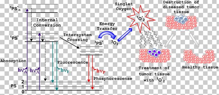 Photodynamic Therapy Singlet Oxygen Jablonski Diagram Photosensitizer PNG, Clipart, Angle, Area, Cancer, Cell, Chemistry Free PNG Download