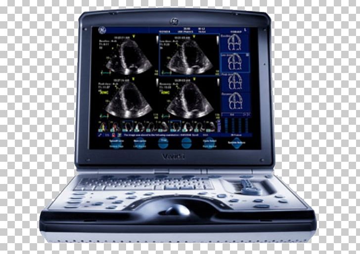 Ultrasonography SonoSite PNG, Clipart, 3d Ultrasound, Cardiac Ultrasound, Cardiology, Cardiovascular Disease, Display Device Free PNG Download