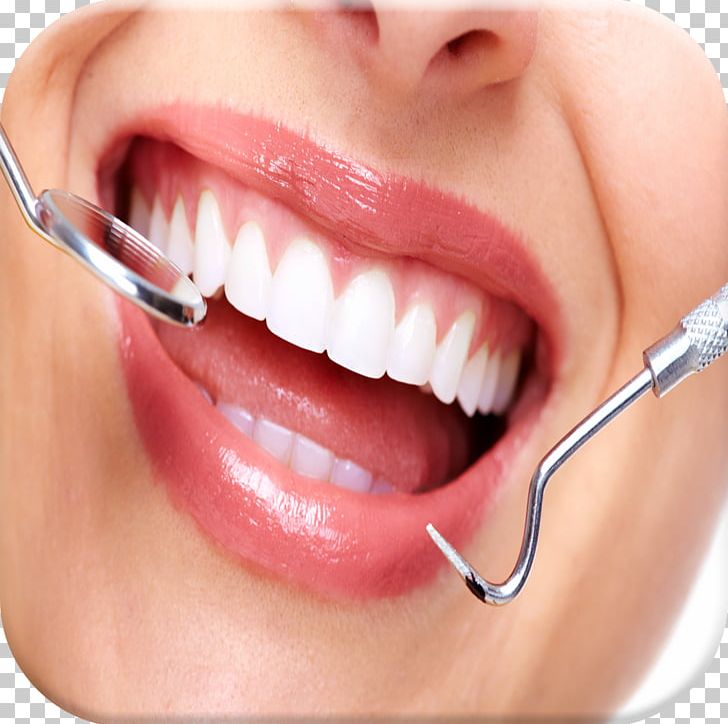Tooth Dentistry Dental Extraction Dental Surgery PNG, Clipart, Beauty, Care, Cheek, Chin, Cosmetic Dentistry Free PNG Download