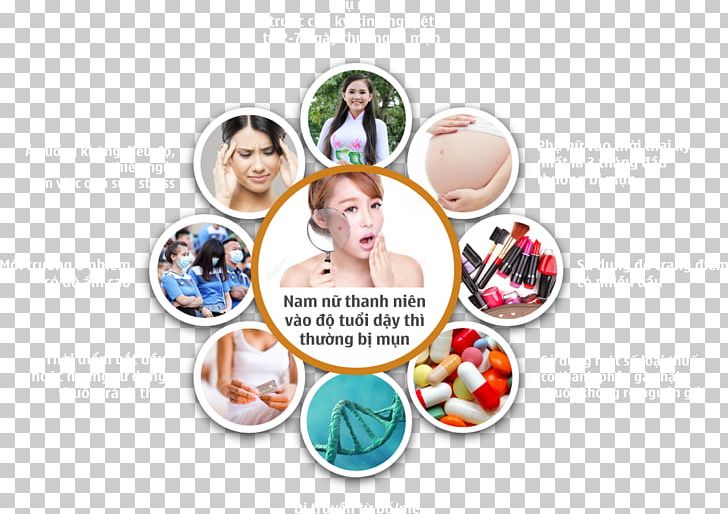 Mụn Acne Vietnam Traditional Chinese Medicine Therapy PNG, Clipart, Acne, Clothing Accessories, Fashion, Fashion Accessory, Howto Free PNG Download