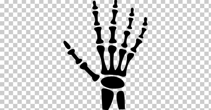 Human Skeleton Carpal Bones Hand Human Body PNG, Clipart, Arm, Black And White, Bone, Branch, Carpal Bones Free PNG Download