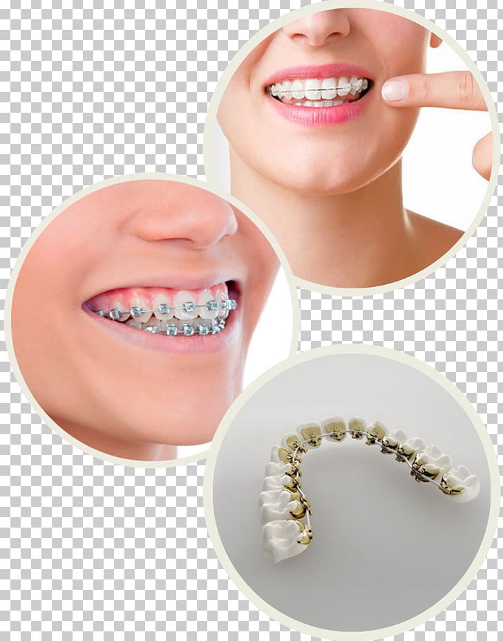 Jaw Tooth Dental Braces Oral Hygiene International Dental Center PNG, Clipart, Animal Bite, Appointment, Center, Cheek, Chin Free PNG Download
