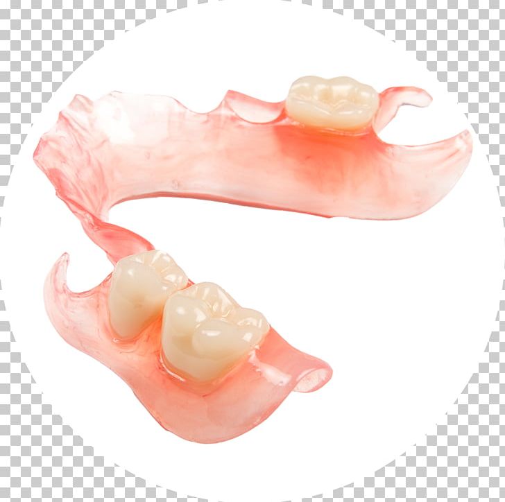 Dentures Dental Laboratory Dentistry Prosthesis PNG, Clipart, Adjustment, Bez, Clear Aligners, Dental Laboratory, Dental Technician Free PNG Download