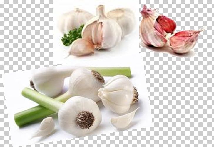 Garlic Vegetable Tursu Food Shallot PNG, Clipart, Apple, Broccoli, Brussels Sprout, Cabbage, Dietary Fiber Free PNG Download