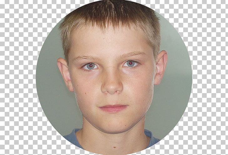 Eyebrow Dyslexia Child Actor Cheek PNG, Clipart, Boy, Cheek, Child, Child Actor, Child Model Free PNG Download