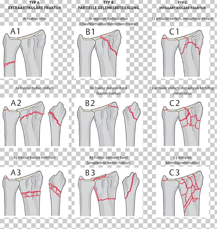 Sleeve Shoulder Clothes Hanger Pattern PNG, Clipart, Abdomen, Art, Clothes Hanger, Clothing, Fashion Design Free PNG Download