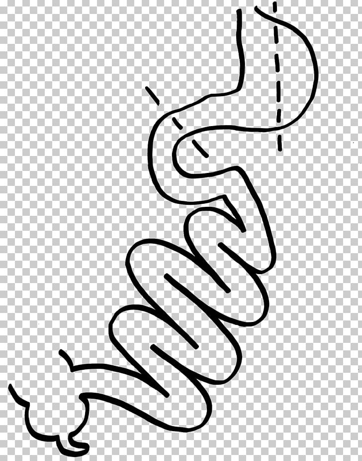 SADI-S Surgery Bariatric Surgery Gastric Bypass Surgery Duodenal Switch PNG, Clipart, Area, Artwork, Bariatrics, Bariatric Surgery, Black Free PNG Download