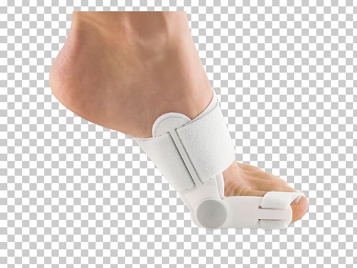 Bunionectomy Splint Hallux Varus PNG, Clipart,  Free PNG Download