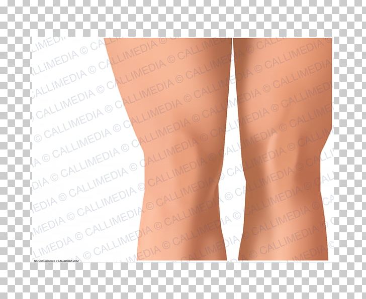 Thigh Knee Human Anatomy Skin PNG, Clipart, Active Undergarment, Anatomy, Ankle, Arm, Calf Free PNG Download