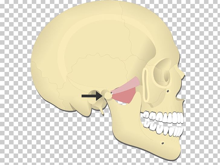 Mandible Medial Pterygoid Muscle Lateral Pterygoid Muscle Temporomandibular Joint Muscles Of Mastication PNG, Clipart, 3d Printing, Anatomy, Angle Of The Mandible, Bone, Condyle Free PNG Download