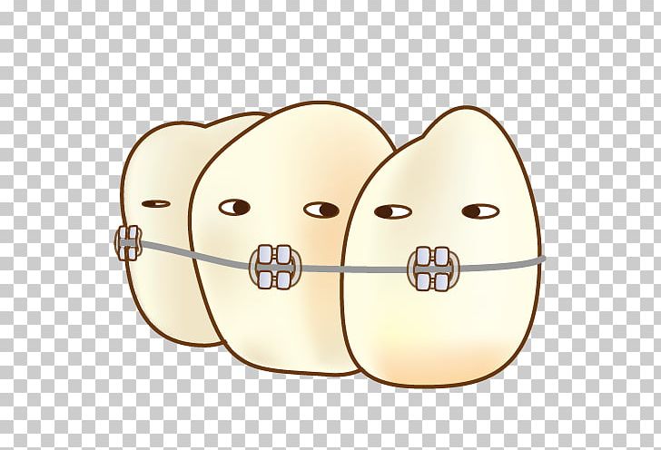 Dental Braces Dentistry 矯正歯科 Dentition PNG, Clipart, Aphthous Stomatitis, Body Jewelry, Character, Dental Braces, Dental Extraction Free PNG Download