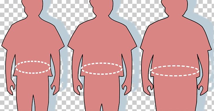 Abdominal Obesity Adipose Tissue Waist Fatty Liver PNG, Clipart, Abdomen, Abdominal Obesity, Arm, Breakthrough, Chest Free PNG Download
