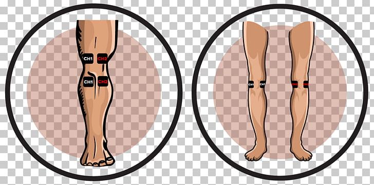 Transcutaneous Electrical Nerve Stimulation Knee Pain Electrode Electrical Muscle Stimulation PNG, Clipart, Arm, Calf, Ear, Electrical Muscle Stimulation, Electrode Free PNG Download