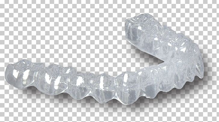 Retainer Dentistry Dental Laboratory Jaw Orthodontics PNG, Clipart, Bridge, Cadcam Dentistry, Crown, Crystal, Dental Implant Cabinet Free PNG Download