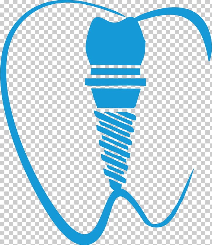 Dental Implant Dentistry Tooth PNG, Clipart, Area, Circle, Computer Icons, Cosmetic Dentistry, Crown Free PNG Download