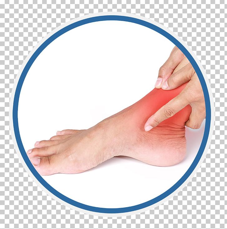 Sprained Ankle Pain Injury PNG, Clipart, Ankle, Ankle Brace, Ankle Fracture, Arm, Bandage Free PNG Download