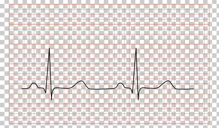 Electrocardiography Electrocardiogram Cardiology Heart Medicine PNG, Clipart, Angle, Area, Cardiac Stress Test, Diagram, Electrocardiogram Free PNG Download