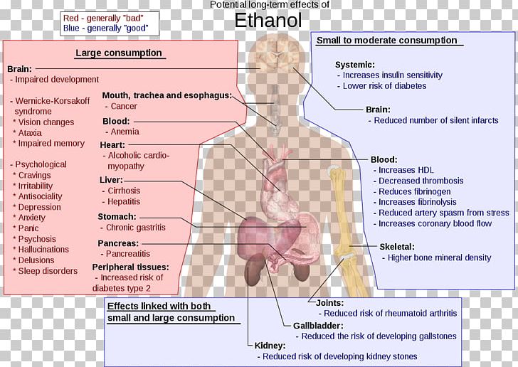 Long-term Effects Of Alcohol Consumption Alcoholism Alcoholic Drink Ethanol Alcohol And Health PNG, Clipart, Abdomen, Adverse Effect, Alcohol Abuse, Alcohol Intoxication, Arm Free PNG Download