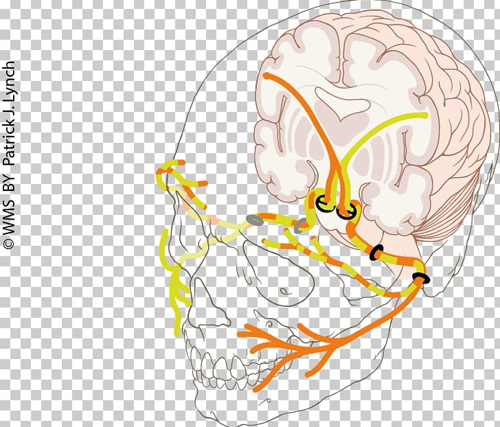Facial Nerve Paralysis Human Anatomy PNG, Clipart, Anatomy, Area, Bone, Brain, Ear Free PNG Download