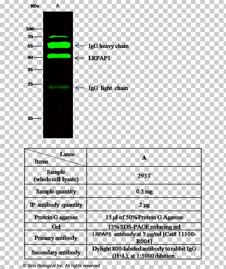 Document Line Angle PNG, Clipart, Angle, Antibody, Area, Art, Diagram Free PNG Download