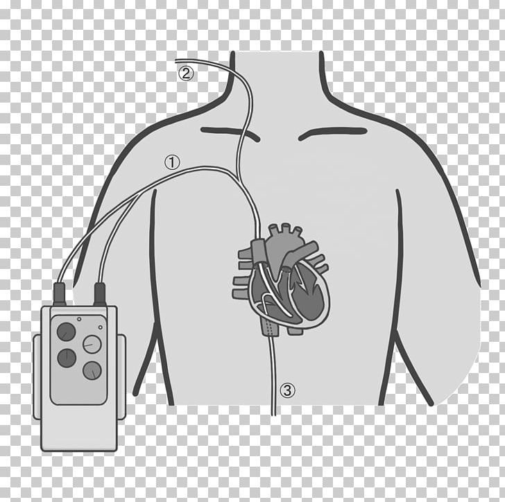 Artificial Cardiac Pacemaker Nursing Medical Device Illustration Automated External Defibrillators PNG, Clipart,  Free PNG Download