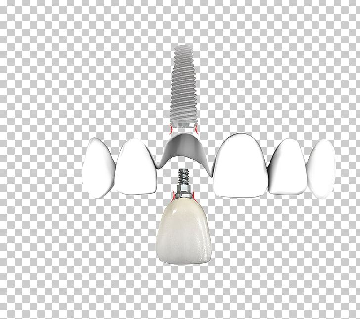 Dentistry Dental Implant Product Design PNG, Clipart, Aesthetics, Dental Implant, Dentist, Dentistry, Experience Free PNG Download