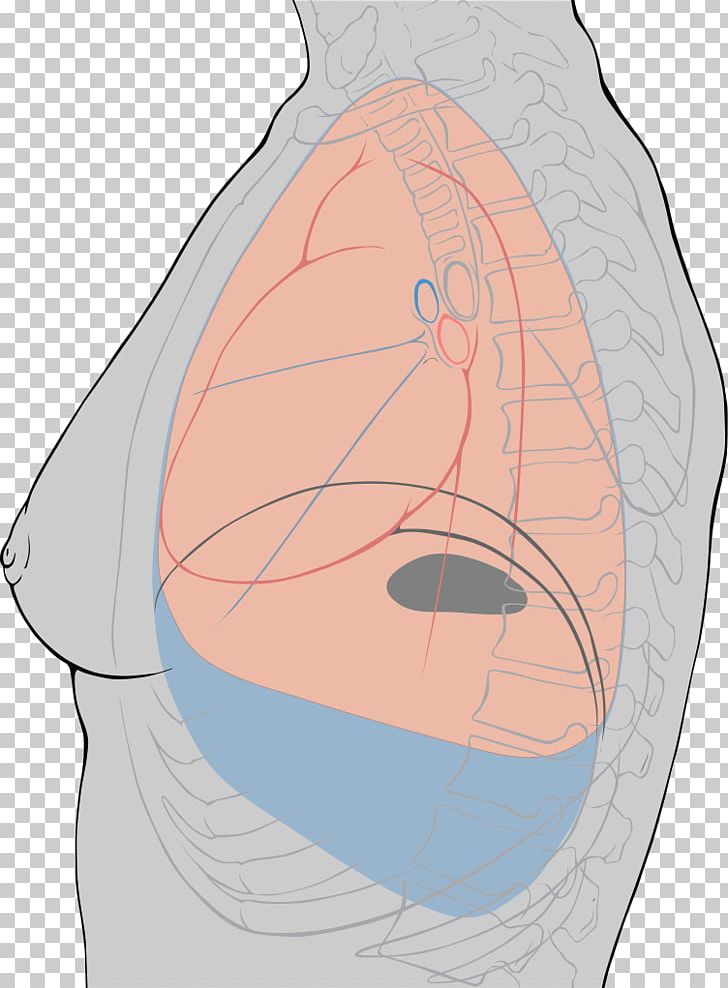 Pleurisy Pleural Cavity Pleural Effusion Lung Inflammation PNG, Clipart, Abdomen, Arm, Breathing, Cheek, Chest Free PNG Download