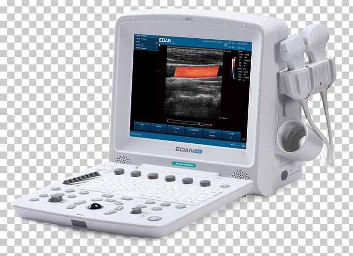 Edan USA Diagnostic Ultrasound Ultrasonography Medical Imaging PNG, Clipart, Communication, Electronic Device, Electronics, Imaging Technology, Medical Free PNG Download