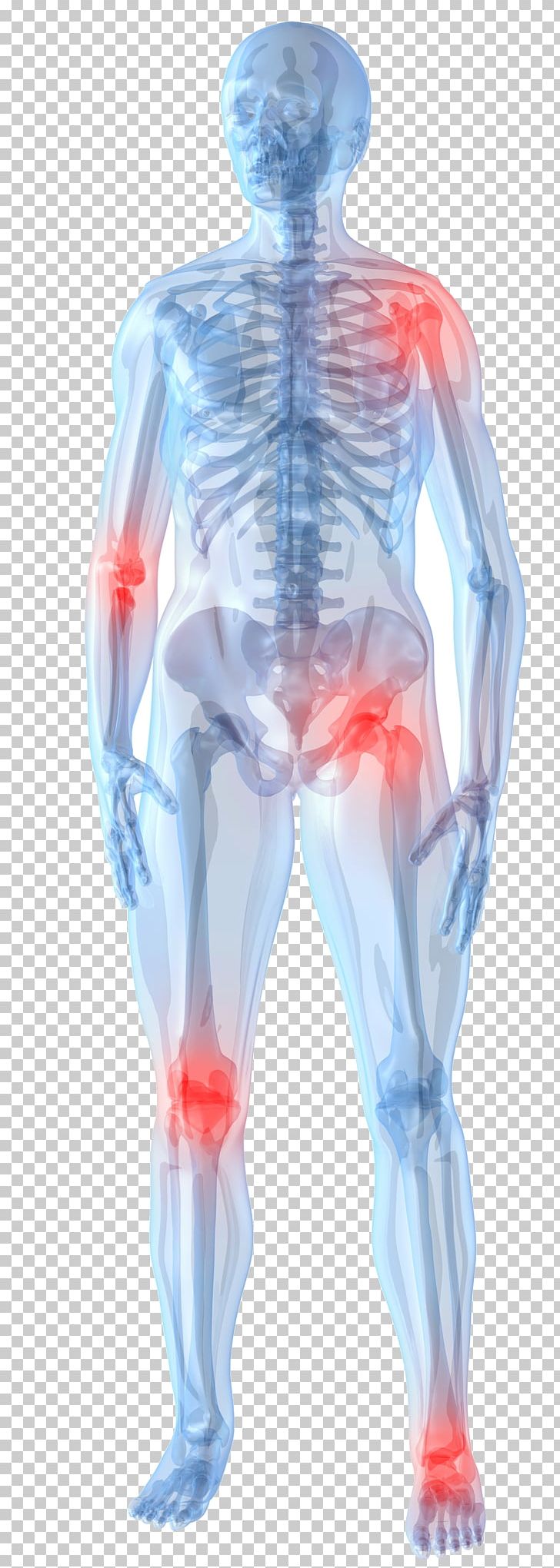 Knee Pain Pain Management Arthritis Joint Pain Therapy PNG, Clipart, Arm, Back Pain, Body Ache, Chest, Chronic Condition Free PNG Download