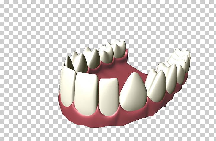 Human Tooth PNG, Clipart, Biting, Computer Icons, Dental Implant, Dentistry, Desktop Wallpaper Free PNG Download