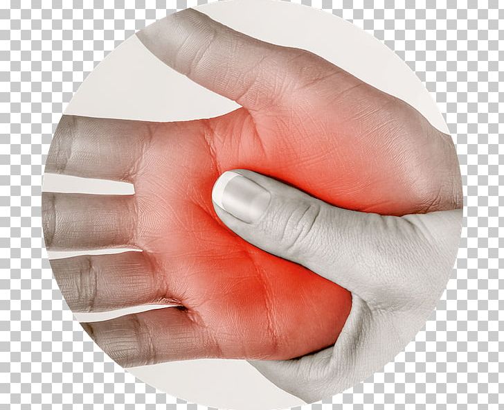 Hand Wrist Pain Foot Finger Therapy PNG, Clipart, Arm, Arthritis, Finger, Foot, Hand Free PNG Download