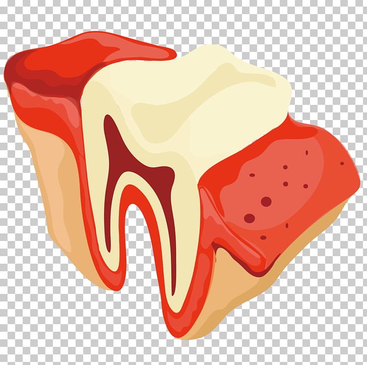 Tooth Dentist Gums PNG, Clipart, Art Deco, Art Vector, Dentistry, Download, Euclidean Vector Free PNG Download