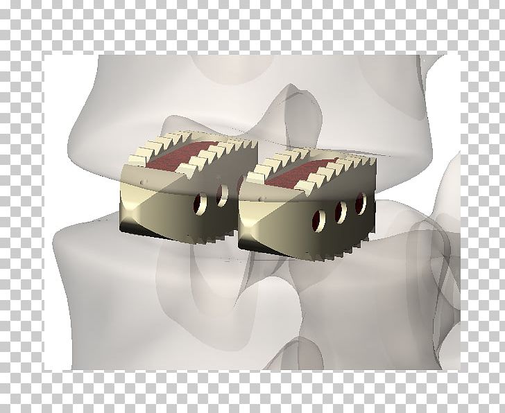 Jaw PNG, Clipart, Art, Box, Jaw, Transdermal Implant Free PNG Download