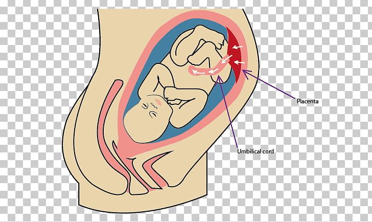 Umbilical Cord Placenta Infant Childbirth PNG, Clipart, Abdomen, Arm, Cartoon, Face, Fictional Character Free PNG Download