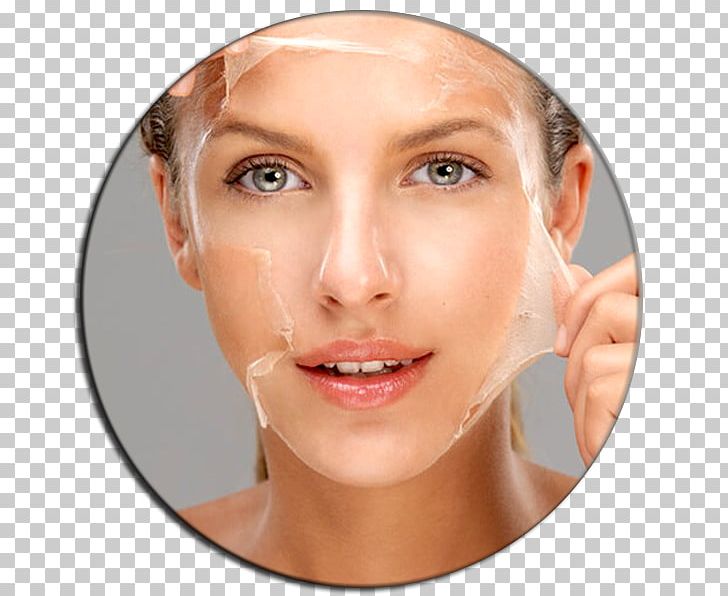 Chemical Peel Exfoliation Facial Skin Face PNG, Clipart, Antiaging Cream, Avon Products, Beauty, Cheek, Chemical Peel Free PNG Download