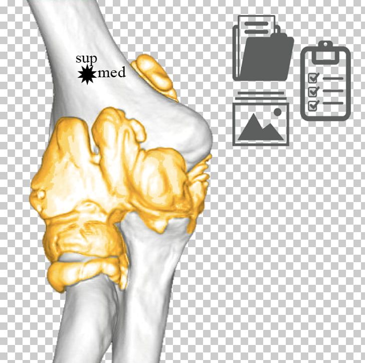 Thumb Ulnar Nerve Elbow Joint Humerus PNG, Clipart, Arm, Arthrology, Bone, Elbow, Finger Free PNG Download