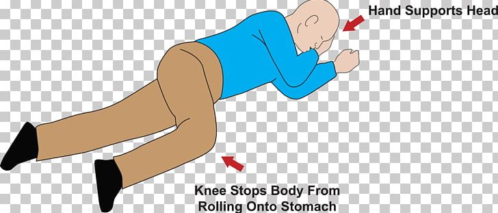 Recovery Position Cardiopulmonary Resuscitation Breathing First Aid Supplies Automated External Defibrillators PNG, Clipart, Airway Management, Angle, Area, Arm, Automated External Defibrillators Free PNG Download