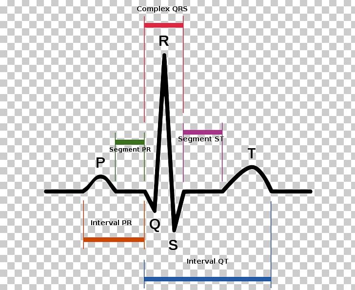 Sinus Rhythm Electrocardiography Heart Rate Sinus Tachycardia PNG, Clipart, Anatomy, Angle, Area, Atrial Fibrillation, Cardiac Cycle Free PNG Download