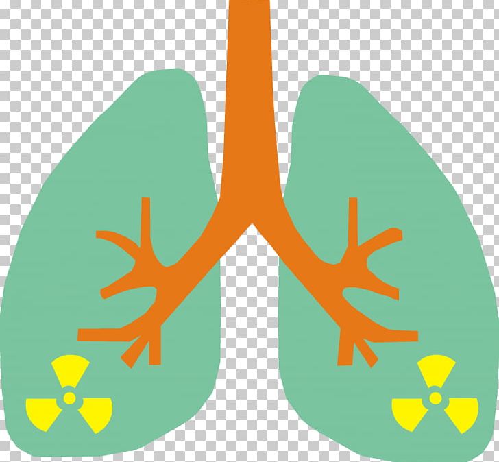 Lung Cancer Radon Smoking PNG, Clipart, Amphibian, Cancer, Cause, Cough, Frog Free PNG Download