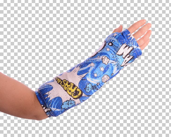 Thumb Orthopedic Cast Arm Bone Fracture Distal Radius Fracture PNG, Clipart, Arm, Blue, Bone Fracture, Broken Arm, Color Free PNG Download