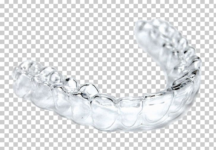 Clear Aligners Dental Braces Orthodontics Dentist Tooth PNG, Clipart, Body Jewelry, Bracelet, Chain, Clear, Clear Aligners Free PNG Download