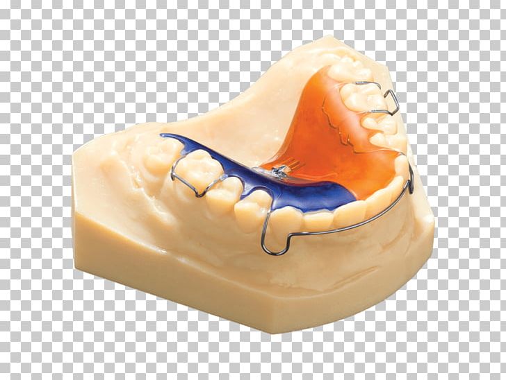 Dentistry Stratasys 3D Printing Objet Geometries PNG, Clipart, 3d Dental Treatment For Toothache, 3d Printing, Cadcam Dentistry, Dental Implant, Dental Laboratory Free PNG Download