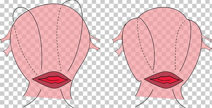 B-Lynch Suture Surgical Suture Postpartum Hemorrhage Uterine Atony Uterus PNG, Clipart, Arm, Bleeding, Drawing, Face, Fictional Character Free PNG Download